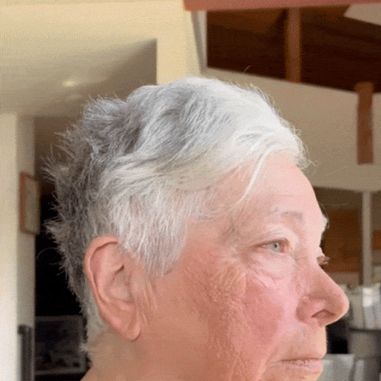 Crema cu venin de albine care întinerește pielea